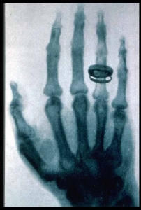 Roentgen-x-ray-von-kollikers-hand.jpg